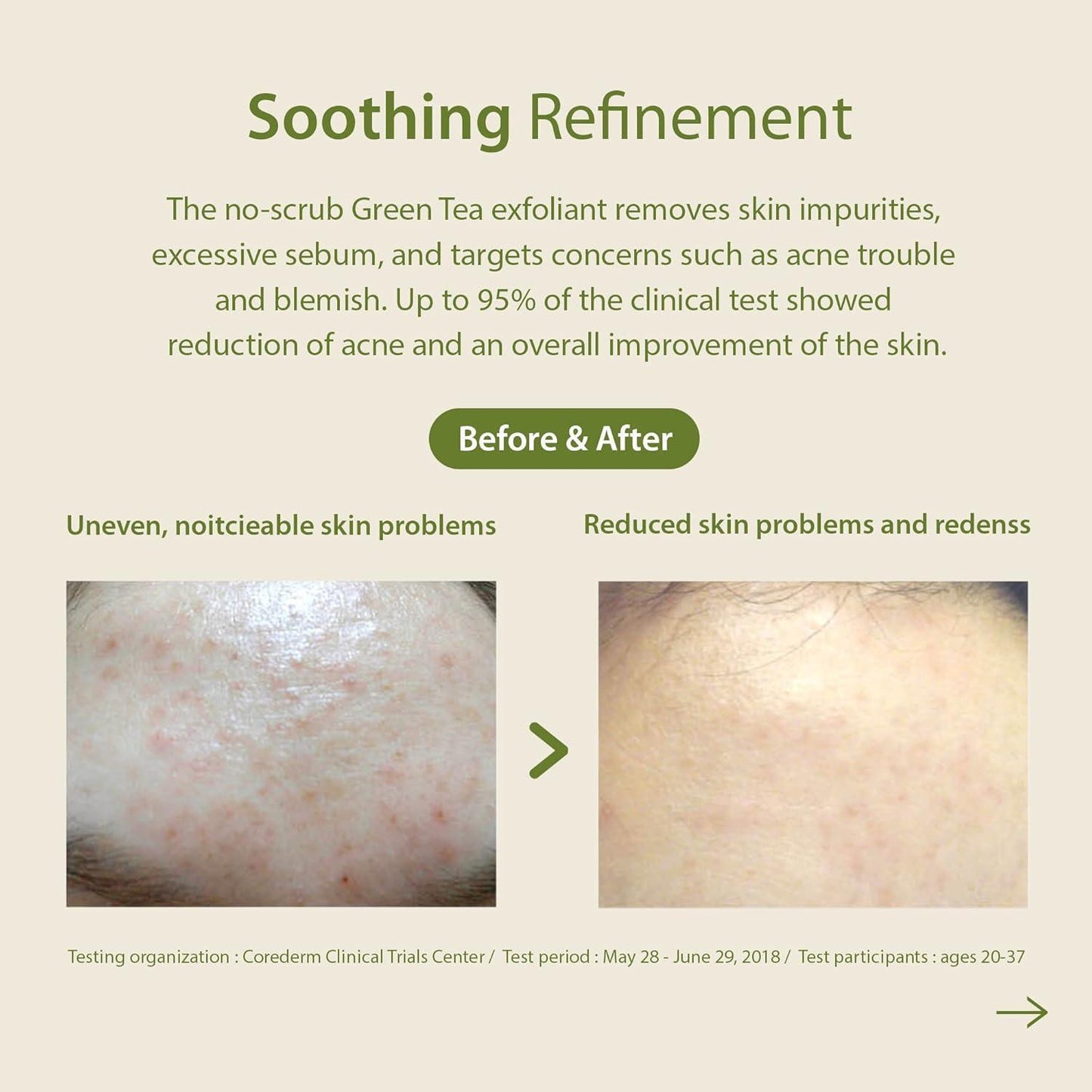 Patting Splash Mask Soothing & Healing Green Tea 150ml