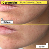 [Dr.Jart+] Ceramidin Ectoin-Infused Cream 50ml